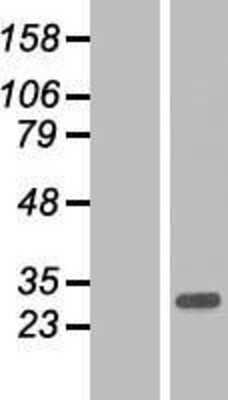 Western Blot: ARL10 Overexpression Lysate (Adult Normal) [NBP2-05130] Left-Empty vector transfected control cell lysate (HEK293 cell lysate); Right -Over-expression Lysate for ARL10.