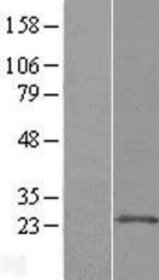 Western Blot ARL11 Overexpression Lysate
