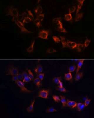 Immunocytochemistry/Immunofluorescence: ARL13B Antibody [NBP2-92454] - Analysis of C6 cells using ARL13B at dilution of 1:100. Blue: DAPI for nuclear staining.