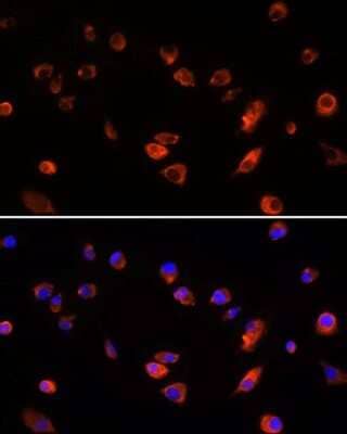 Immunocytochemistry/Immunofluorescence: ARL13B Antibody [NBP2-92454] - Analysis of L929 cells using ARL13B at dilution of 1:100. Blue: DAPI for nuclear staining.