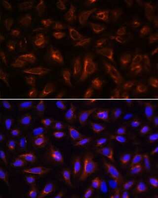 Immunocytochemistry/Immunofluorescence: ARL13B Antibody [NBP2-92454] - Analysis of U-2 OS cells using ARL13B at dilution of 1:100. Blue: DAPI for nuclear staining.