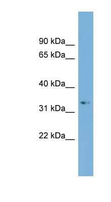 Western Blot: ARL13B Antibody [NBP1-55498] - Titration: 0.2-1 ug/ml, Positive Control: Jurkat cell lysate.