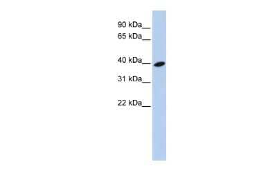 Western Blot: ARL13B Antibody [NBP1-56715] - Reccomended Titration: 0.2 - 1 ug/ml ELISA Titer: 1:312500 Positive Control: 721_B cell lysate