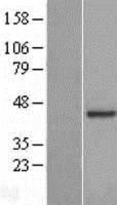 Western Blot: ARL13B Overexpression Lysate (Adult Normal) [NBL1-07689] Left-Empty vector transfected control cell lysate (HEK293 cell lysate); Right -Over-expression Lysate for ARL13B.