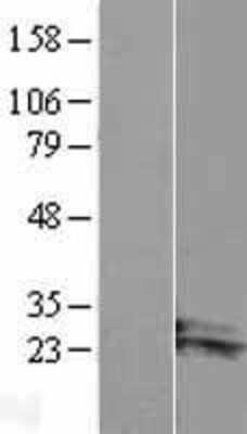 Western Blot ARL14 Overexpression Lysate