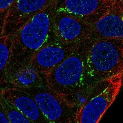 Immunocytochemistry/Immunofluorescence: ARL15 Antibody [NBP2-56877] - Staining of human cell line RT4 shows localization to plasma membrane, the Golgi apparatus & cell junctions.