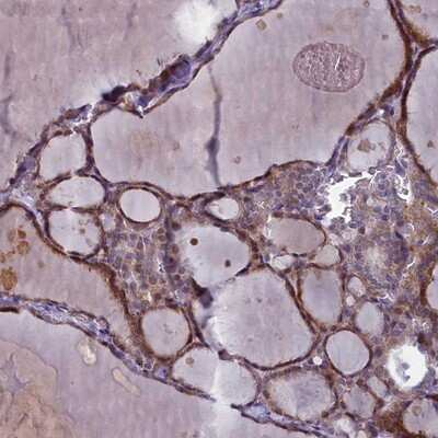 Immunohistochemistry-Paraffin: ARL15 Antibody [NBP1-94142] - Staining of human thyroid gland shows distinct cytoplasmic positivity in glandular cells.