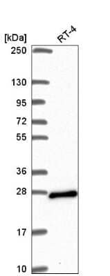 Western Blot: ARL15 Antibody [NBP2-56877] - Western blot analysis in human cell line RT-4.