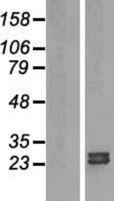 Western Blot: ARL15 Overexpression Lysate (Adult Normal) [NBL1-07691] Left-Empty vector transfected control cell lysate (HEK293 cell lysate); Right -Over-expression Lysate for ARL15.