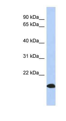 Western Blot: ARL17 Antibody [NBP1-70411] - Titration: 0.2-1 ug/ml, Positive Control: Human Placenta.