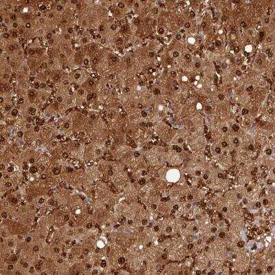 Immunohistochemistry-Paraffin: ARL17A Antibody [NBP2-59794] - Human liver shows strong cytoplasmic and nuclear positivity in hepatocytes.