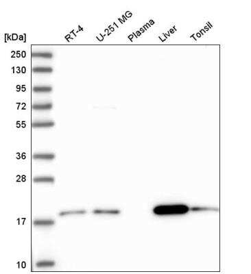 Western Blot: ARL17A Antibody [NBP2-59794] - Analysis in human cell line RT-4, human cell line U-251 MG, human plasma, human liver tissue and human tonsil tissue.