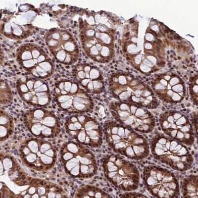 Immunohistochemistry-Paraffin: ARL2 Antibody [NBP1-91680] - Staining of human colon shows strong nuclear and cytoplasmic positivity in glandular cells.