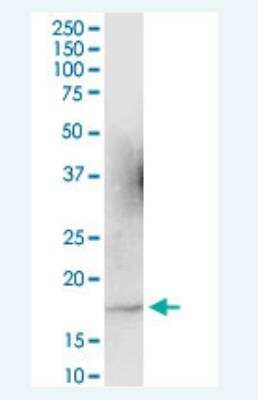 Western Blot: ARL2 Antibody [H00000402-B01P-50ug] - Analysis of ARL2 expression in rat brain.