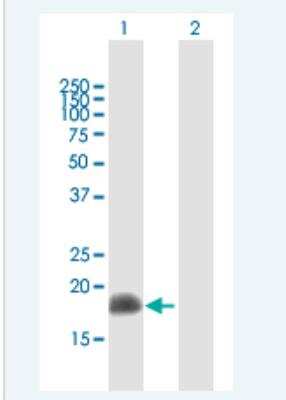 Western Blot: ARL2 Antibody [H00000402-B01P-50ug] - Analysis of ARL2 expression in transfected 293T cell line (H00000402-T01) by ARL2 MaxPab polyclonal antibody. Lane 1: ARL2 transfected lysate(20.24 KDa). Lane 2: Non-transfected lysate