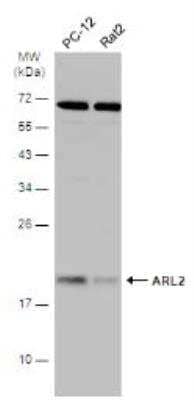 Western Blot: ARL2 Antibody [NBP1-30939] - Various whole cell extracts (30 ug) were separated by 12% SDS-PAGE, and the membrane was blotted with ARL2 antibody (NBP1-30939). The HRP-conjugated anti-rabbit IgG antibody was used to detect the primary antibody.