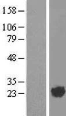 Western Blot ARL2 Overexpression Lysate