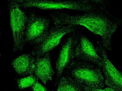 Immunocytochemistry/Immunofluorescence: ARL2BP Antibody (001) [NBP2-90277] - Immunofluorescence staining of ARL2BP in U2OS cells. Cells were fixed with 4% PFA, permeabilzed with 0.3% Triton X-100 in PBS, blocked with 10% serum, and incubated with rabbit anti-human ARL2BP monoclonal antibody (1:60) at 4C overnight. Then cells were stained with the Alexa Fluor(TM) 488-conjugated Goat Anti-rabbit IgG secondary antibody (green).