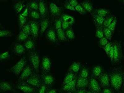 Immunocytochemistry/Immunofluorescence: ARL2BP Antibody [NBP2-98591] - Immunofluorescence staining of ARL2BP in U2OS cells. Cells were fixed with 4% PFA, permeabilzed with 0.1% Triton X-100 in PBS, blocked with 10% serum, and incubated with rabbit anti-Human ARL2BP polyclonal antibody (dilution ratio 1:200) at 4C overnight. Then cells were stained with the Alexa Fluor(R)488-conjugated Goat Anti-rabbit IgG secondary antibody (green). Positive staining was localized to Nucleus and Cytoplasm.