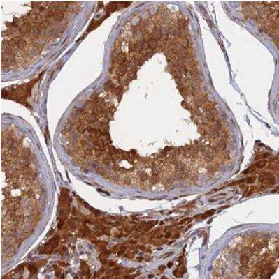 Immunohistochemistry: ARL2BP Antibody [NBP2-30477] - Staining of human testis shows strong cytoplasmic and nuclear positivity in cells in seminiferus tubules and Leydig cells.