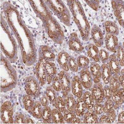 Immunohistochemistry: ARL2BP Antibody [NBP2-30681] - Staining of human stomach, lower shows distinct granular cytoplasmic positivity in glandular cells.