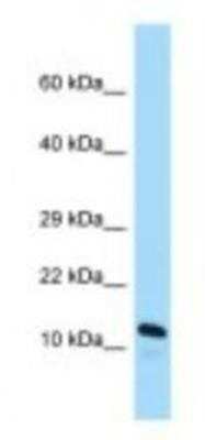 Western Blot: ARL2BP Antibody [NBP1-98397] - Mouse Small Intestine Lysate 1.0ug/ml, Gel Concentration: 10-20%