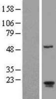 Western Blot ARL2BP Overexpression Lysate