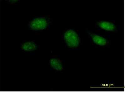 Immunocytochemistry/Immunofluorescence: ARL3 Antibody [H00000403-B02P] - Analysis of purified antibody to ARL3 on HeLa cell. (antibody concentration 10 ug/ml)