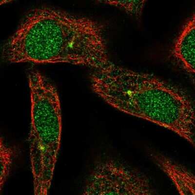 Immunocytochemistry/Immunofluorescence: ARL3 Antibody [NBP2-57304] - Staining of human cell line A549 shows localization to nucleus & centrosome.