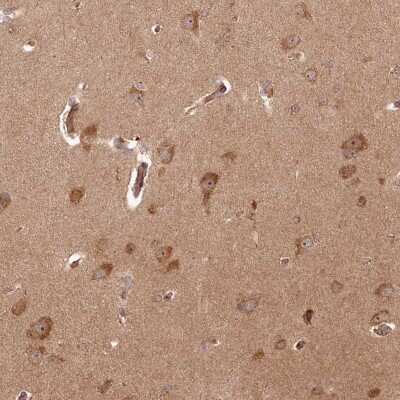 Immunohistochemistry-Paraffin: ARL3 Antibody [NBP1-88839] - Staining of human cerebral cortex shows strong cytoplasmic and nucleolar positivity in neuronal cells.