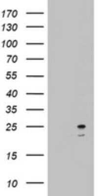Western Blot: ARL3 Antibody (OTI1C6) - Azide and BSA Free [NBP2-70206] - Analysis of HEK293T cells were transfected with the pCMV6-ENTRY control (Left lane) or pCMV6-ENTRY ARL3.