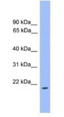 Western Blot: ARL3 Antibody [NBP1-69096] - MCF7 Cell Lystae 1ug/ml Gel Concentration 12%