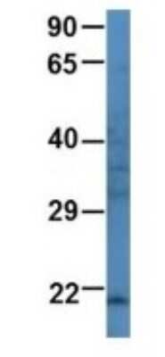 Western Blot: ARL3 Antibody [NBP1-69096] - Human 721_B, Antibody Dilution: 1.0 ug/ml ARL3 is supported by BioGPS gene expression data to be expressed in 721_B.