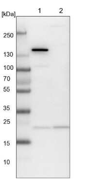 Western Blot: ARL3 Antibody [NBP1-88839] - Lane 1: NIH-3T3 cell lysate (Mouse embryonic fibroblast cells). Lane 2: NBT-II cell lysate (Rat Wistar bladder tumor cells).