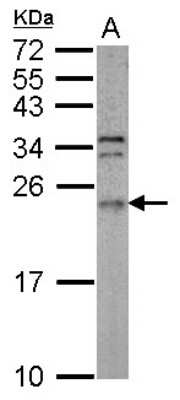 Western Blot: ARL3 Antibody [NBP2-15464] - Sample (50 ug of whole cell lysate) A: Mouse Brain, 12% SDS PAGE gel, diluted at 1:1000.