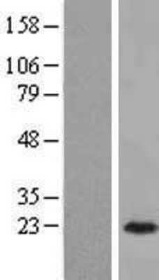 Western Blot: ARL3 Overexpression Lysate (Adult Normal) [NBL1-07694] Left-Empty vector transfected control cell lysate (HEK293 cell lysate); Right -Over-expression Lysate for ARL3.