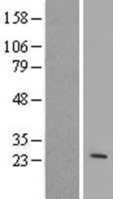 Western Blot: ARL4 Overexpression Lysate (Adult Normal) [NBL1-07695] Left-Empty vector transfected control cell lysate (HEK293 cell lysate); Right -Over-expression Lysate for ARL4.
