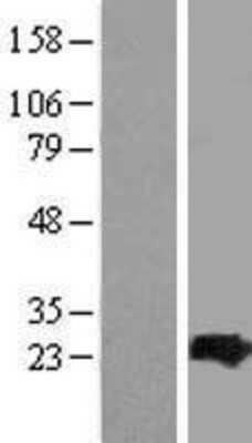 Western Blot: ARL4C Overexpression Lysate (Adult Normal) [NBP2-07712] Left-Empty vector transfected control cell lysate (HEK293 cell lysate); Right -Over-expression Lysate for ARL4C.