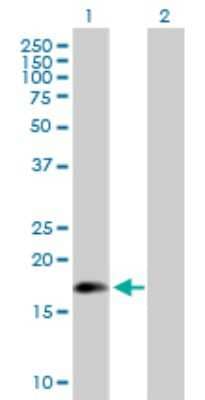 Western Blot: ARL5A Antibody [H00026225-B01P] - Analysis of ARL5A expression in transfected 293T cell line by ARL5A polyclonal antibody.  Lane 1: ARL5A transfected lysate(19.69 KDa). Lane 2: Non-transfected lysate.