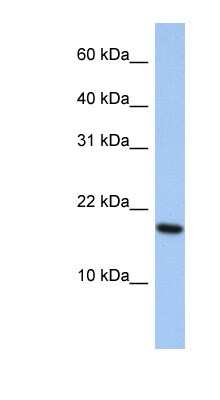 Western Blot ARL5A Antibody - BSA Free
