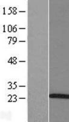 Western Blot ARL5A Overexpression Lysate