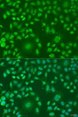 Immunocytochemistry/Immunofluorescence: ARL6 Antibody [NBP2-92628] - Analysis of U2OS cells using ARL6 at dilution of 1:100. Blue: DAPI for nuclear staining.