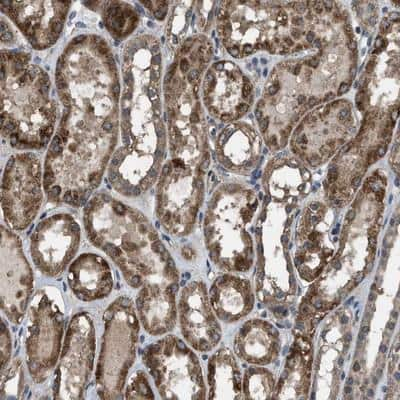 Immunohistochemistry-Paraffin: ARL6 Antibody [NBP1-88689] - Staining of human kidney shows strong cytoplasmic positivity in tubules.