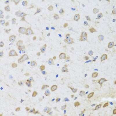 Immunohistochemistry-Paraffin: ARL6 Antibody [NBP2-92831] - Paraffin-embedded mouse brain using ARL6 .