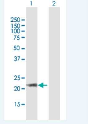 Western Blot: ARL6 Antibody [H00084100-B01P-50ug] - Analysis of ARL6 expression in transfected 293T cell line  by ARL6 MaxPab polyclonal antibody.  Lane 1: ARL6 transfected lysate(20.46 KDa).Lane 2: Non-transfected lysate.