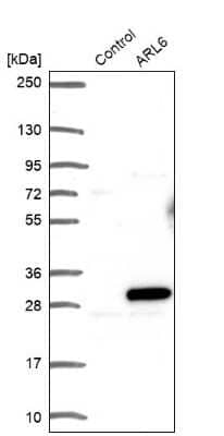 Western Blot: ARL6 Antibody [NBP1-88689] - Analysis in control (vector only transfected HEK293T lysate) and ARL6 over-expression lysate (Co-expressed with a C-terminal myc-DDK tag (3.1 kDa) in mammalian HEK293T cells).