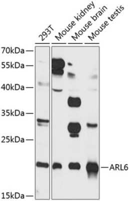 Western Blot: ARL6 Antibody [NBP2-92831] - Analysis of extracts of various cell lines, using ARL6 at 1:1000 dilution.Secondary antibody: HRP Goat Anti-Rabbit IgG (H+L) at 1:10000 dilution.Lysates/proteins: 25ug per lane.Blocking buffer: 3% nonfat dry milk in TBST.Detection: ECL Basic Kit .Exposure time: 90s.