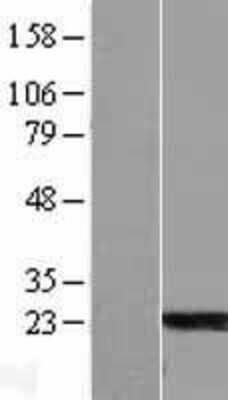 Western Blot: ARL6 Overexpression Lysate (Adult Normal) [NBL1-07699] Left-Empty vector transfected control cell lysate (HEK293 cell lysate); Right -Over-expression Lysate for ARL6.