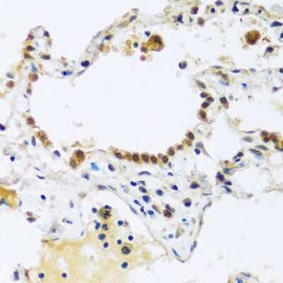 Immunohistochemistry-Paraffin: ARL6IP4 Antibody [NBP3-04956] - Paraffin-embedded human lung using ARL6IP4 antibody at dilution of 1:100 (40x lens).