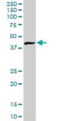 Western Blot: ARL6IP4 Antibody [H00051329-D01P] - Analysis of ARL6IP4 expression in human liver.